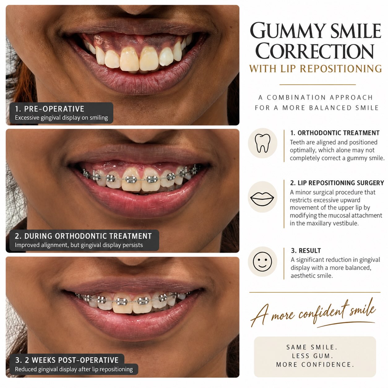 Impacted Wisdom Tooth Removal &mdash; Dr. Mahesh Pund